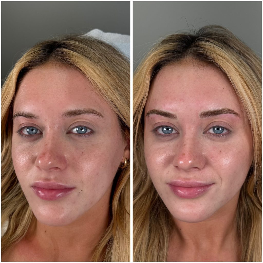 Celebrity Microblading
