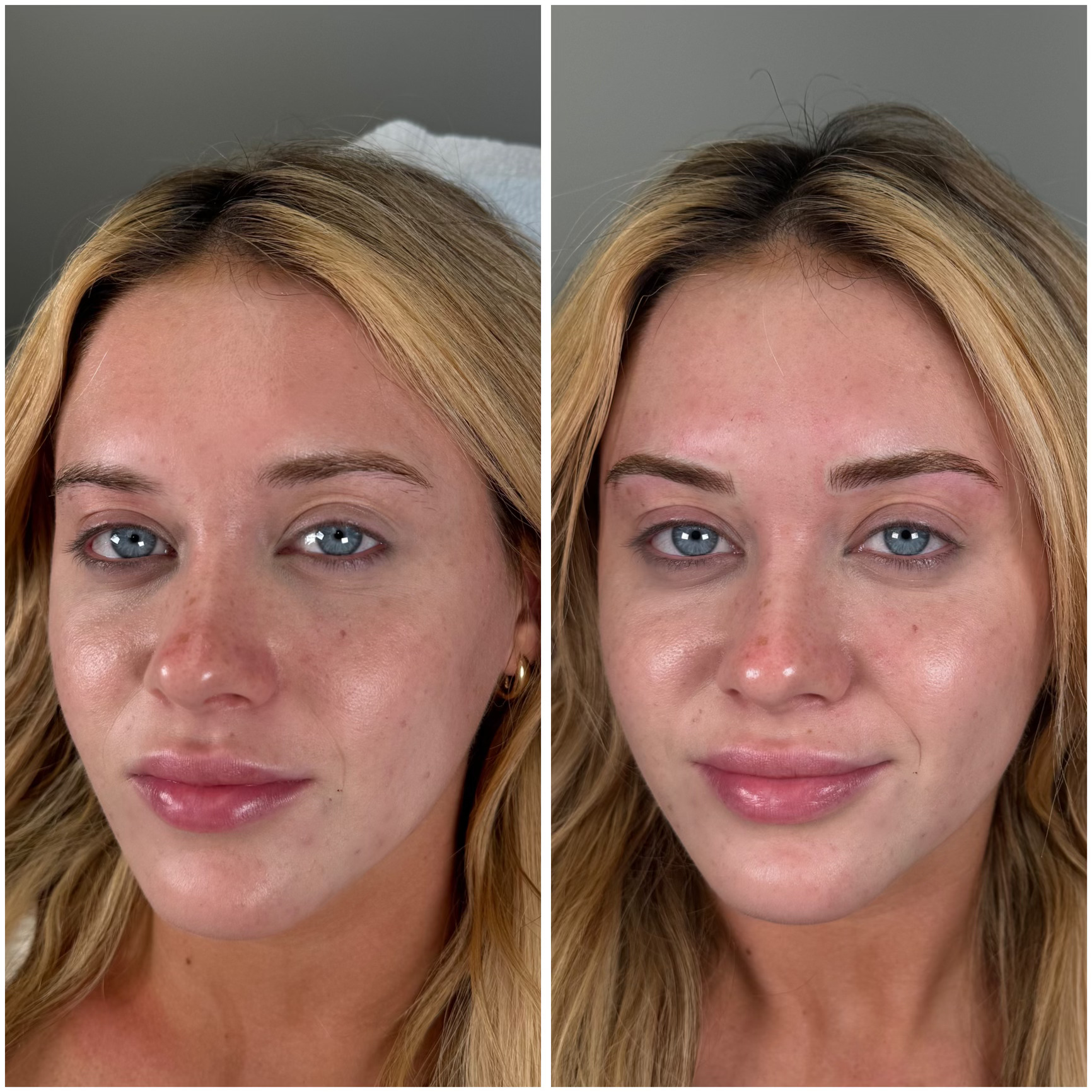 Celebrity Microblading