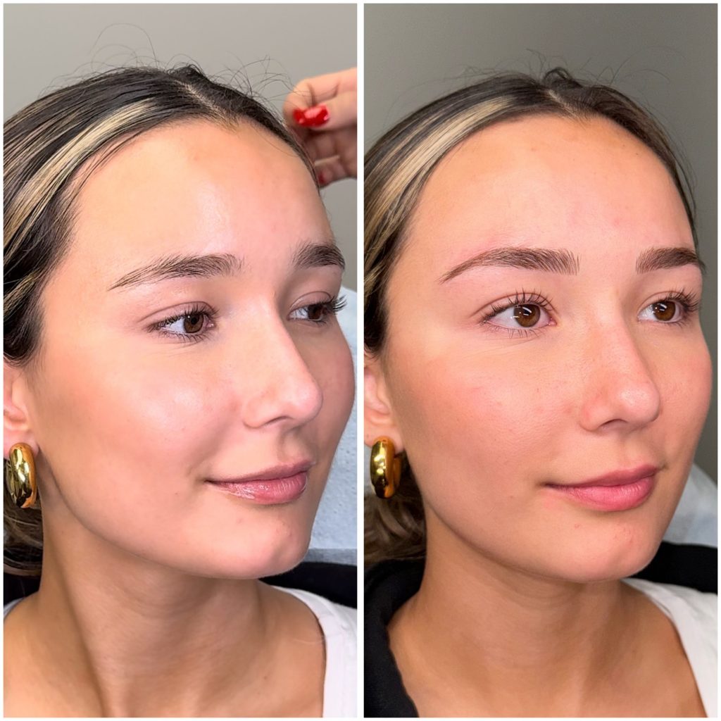 Eyebrow Microblading