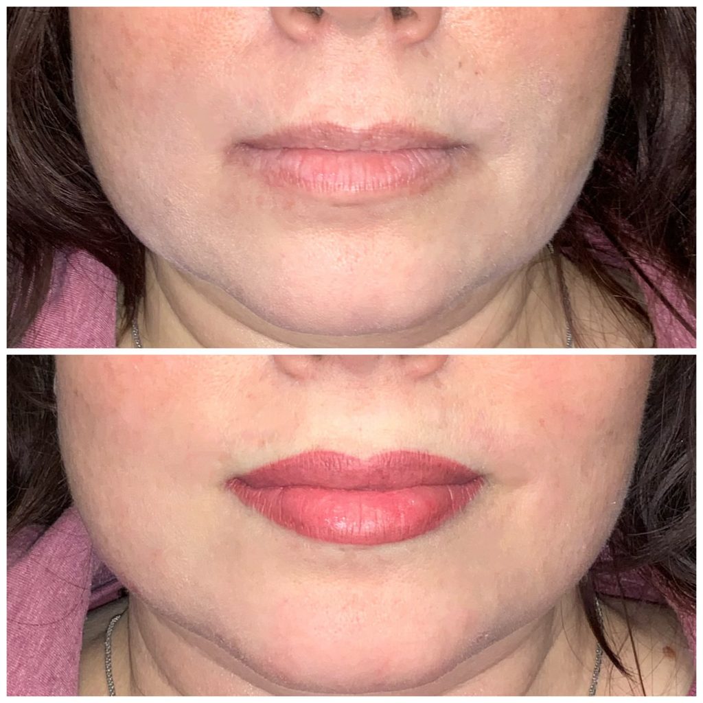 Lip Blushing