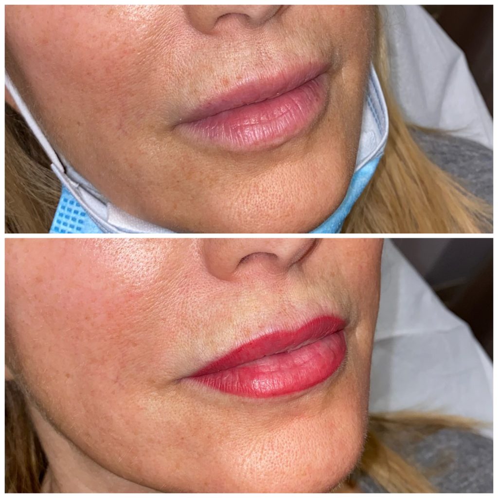 Lip Blushing