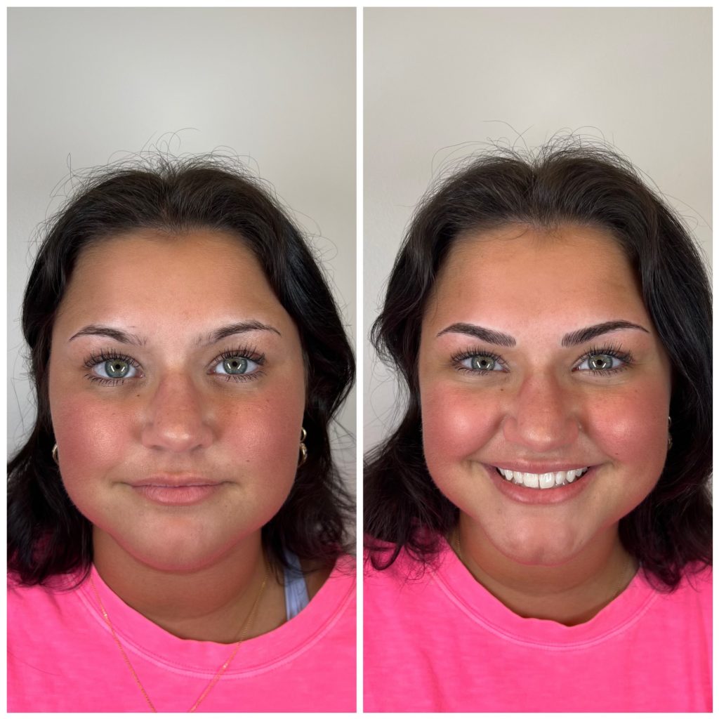 Microblading