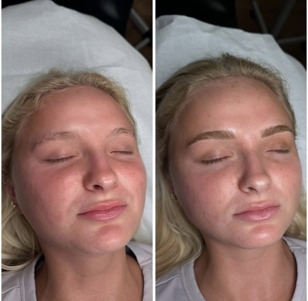 Microblading Blonde Brow