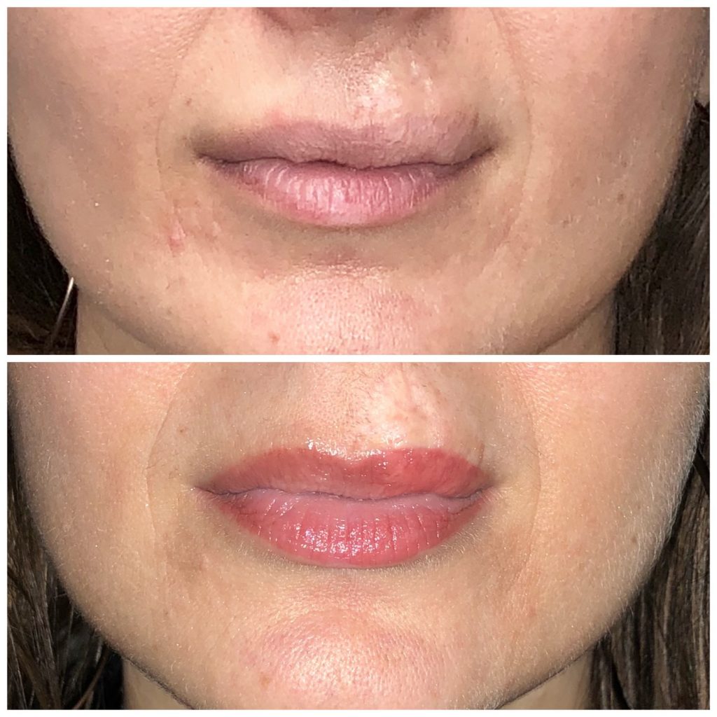 Permanent Lip Color