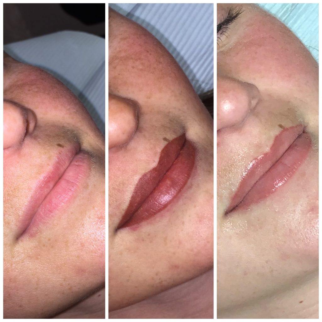 Permanent Lip Color Before, Immediately after, Healed