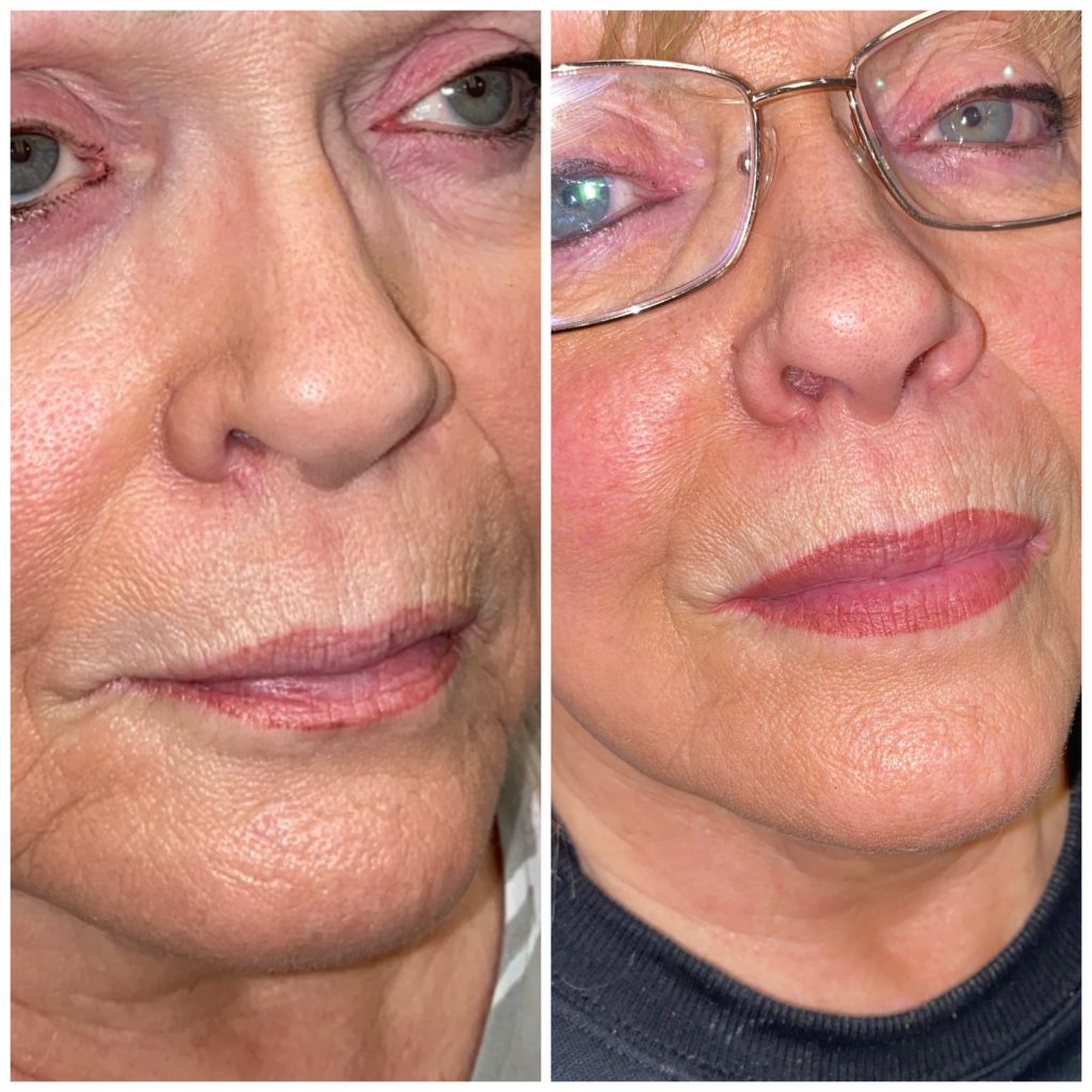 Permanent Lip Color Healed