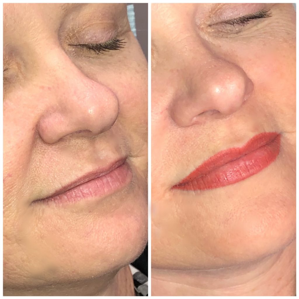 Permanent Lip Color Immediately after procedure