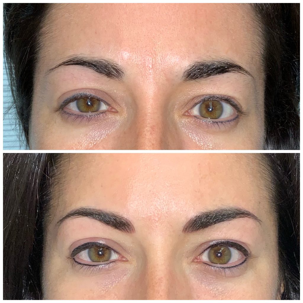 Permanent Eyeliner Permanent Eyeliner