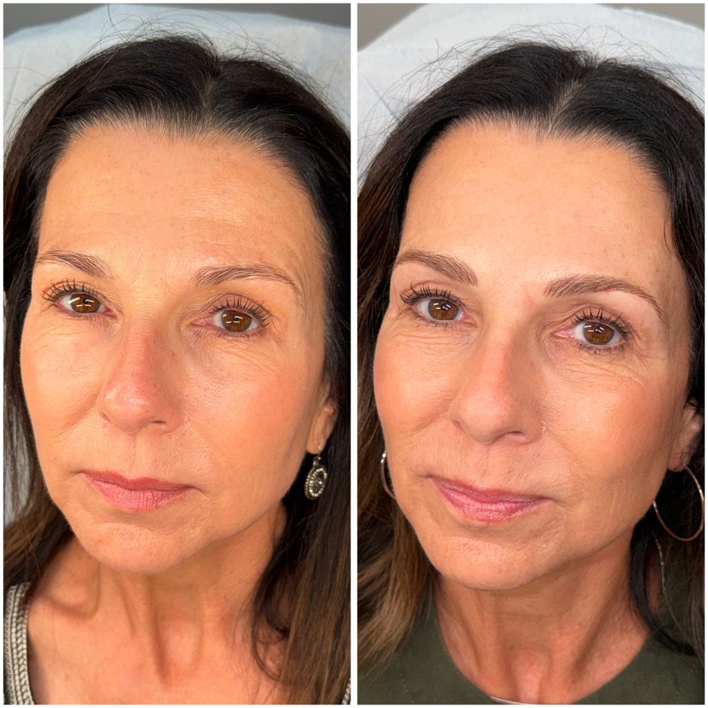 Permanent Eyebrows Permanent Eyebrows