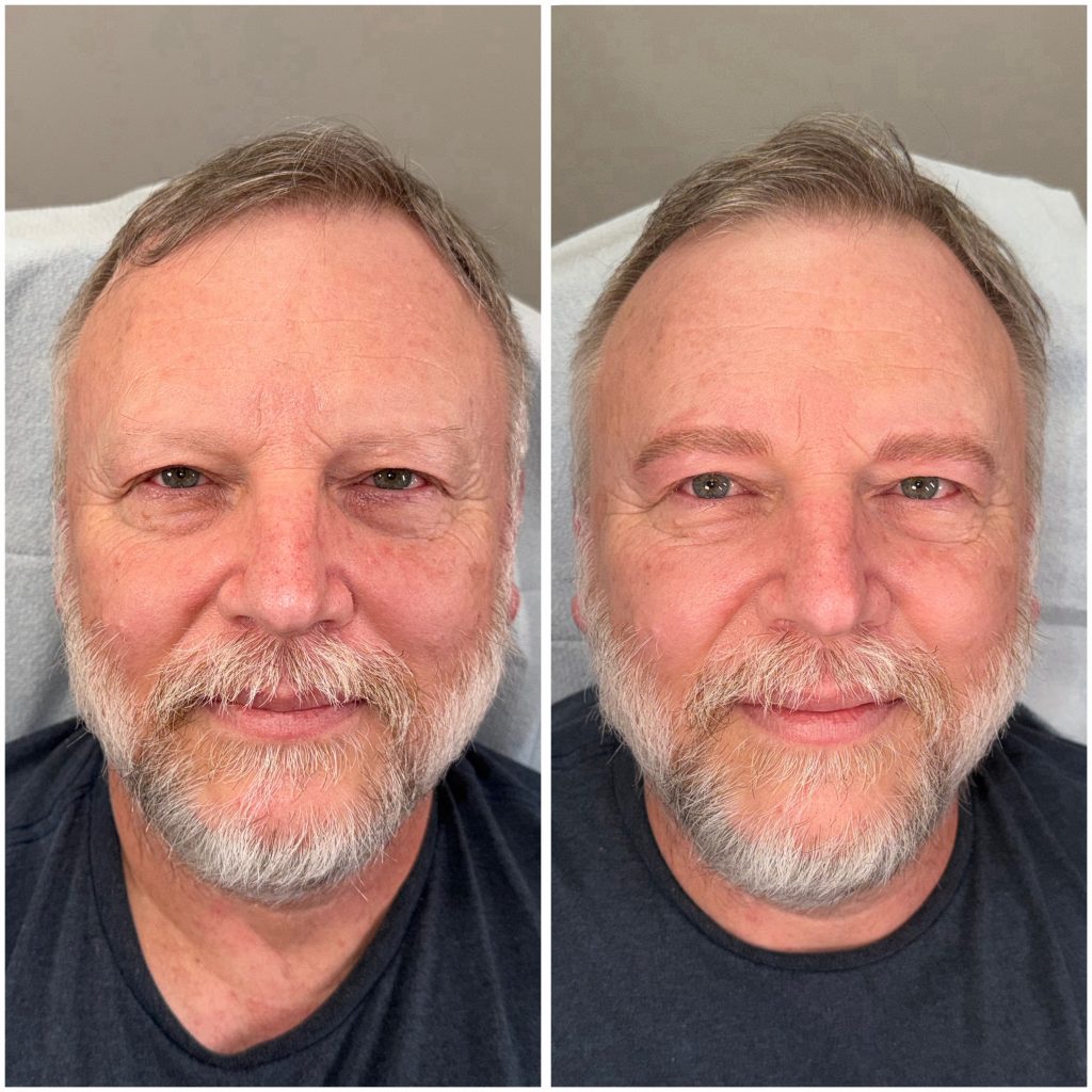 Male Nanobrow