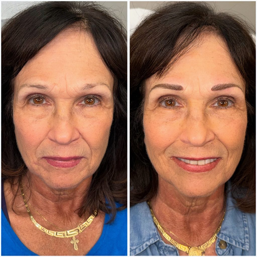 Permanent Eyebrows Permanent Eyebrows