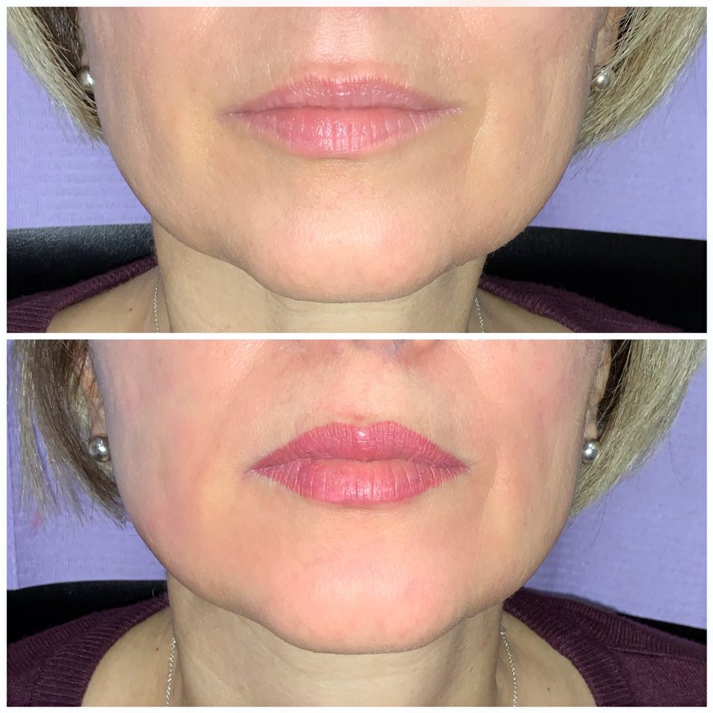Lips Lips