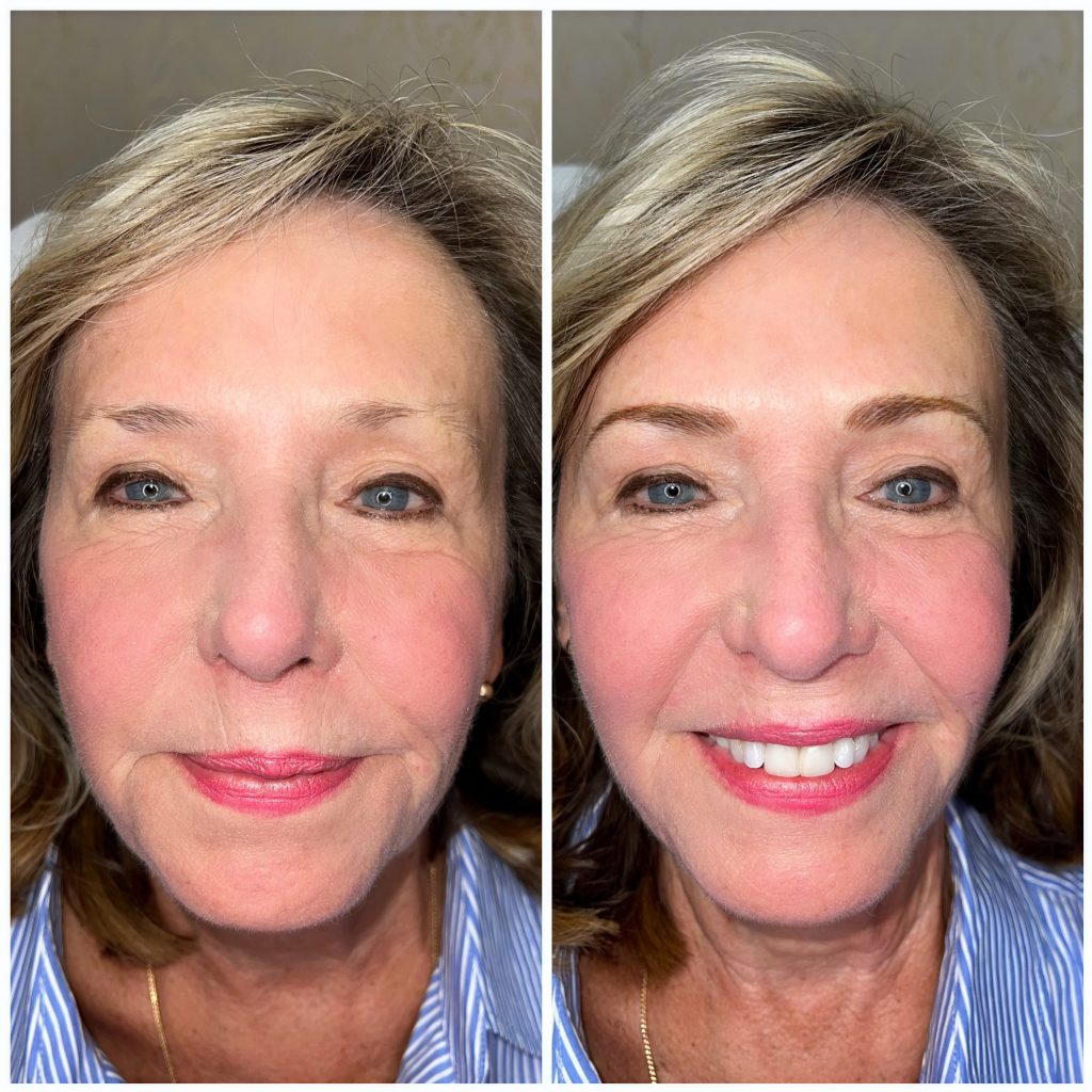 Permanent Eyebrows Permanent Eyebrows