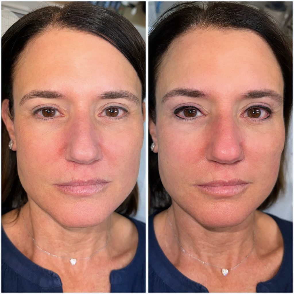 Permanent Eyeliner Permanent Eyeliner