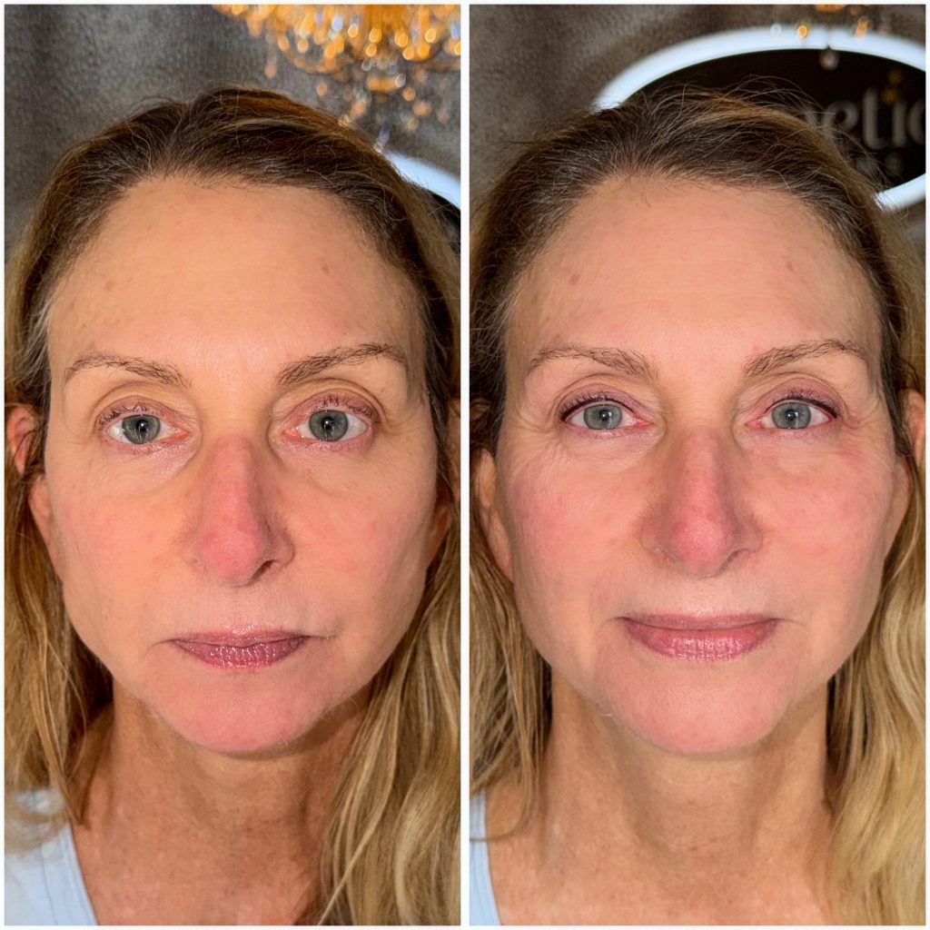 Permanent Eyeliner Permanent Eyeliner