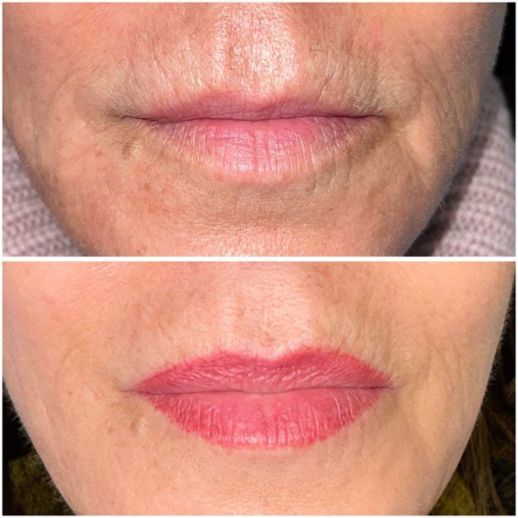 Lips Lips